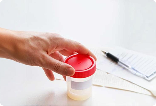 At-home semen analysis